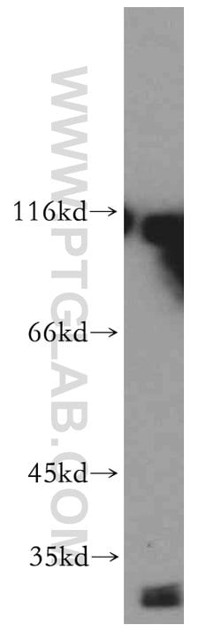 RADIL Rabbit anti-Human, Polyclonal, Proteintech:Antibodies:Primary Antibodies
