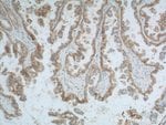 Thumbnail_CD47 Rabbit anti-Human, Polyclonal, Proteintech 150 &mu;L; Unconjugated:Antibodies,