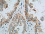 Thumbnail_CD47 Rabbit anti-Human, Polyclonal, Proteintech 150 &mu;L; Unconjugated:Antibodies,