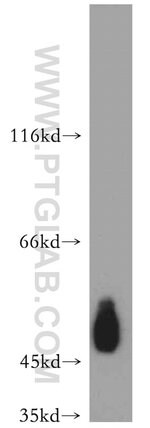 Thumbnail_CD47 Rabbit anti-Human, Polyclonal, Proteintech 150 &mu;L; Unconjugated:Antibodies,