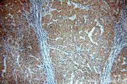 ELOVL2 Rabbit anti-Human, Mouse, Rat, Polyclonal, Proteintech 150 &mu;L;