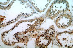 ELOVL2 Rabbit anti-Human, Mouse, Rat, Polyclonal, Proteintech 150 &mu;L;
