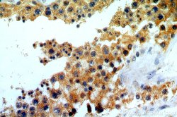 ELOVL2 Rabbit anti-Human, Mouse, Rat, Polyclonal, Proteintech 150 &mu;L;