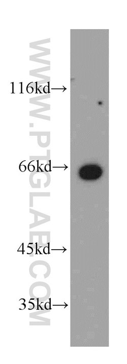 MEF2C Rabbit anti-Human, Mouse, Rat, Polyclonal, Proteintech 150 &mu;L;