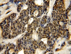 YBX1 Rabbit anti-Human, Mouse, Polyclonal, Proteintech 20 &mu;L; Unconjugated:Antibodies,