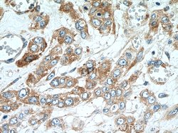 YBX1 Rabbit anti-Human, Mouse, Polyclonal, Proteintech 20 &mu;L; Unconjugated:Antibodies,