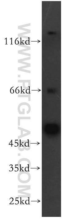 YBX1 Rabbit anti-Human, Mouse, Polyclonal, Proteintech 20 &mu;L; Unconjugated:Antibodies,