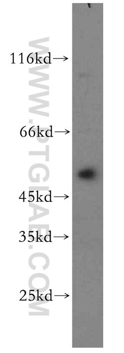 YBX1 Rabbit anti-Human, Mouse, Polyclonal, Proteintech 20 &mu;L; Unconjugated:Antibodies,