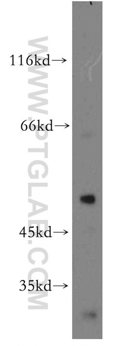 YBX1 Rabbit anti-Human, Mouse, Polyclonal, Proteintech 20 &mu;L; Unconjugated:Antibodies,