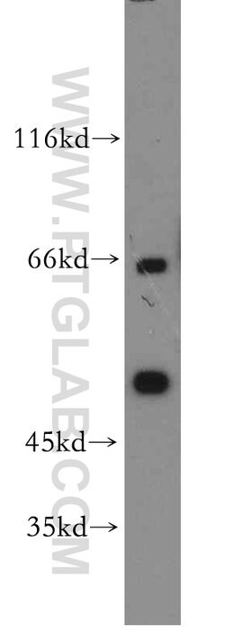 YBX1 Rabbit anti-Human, Mouse, Polyclonal, Proteintech 20 &mu;L; Unconjugated:Antibodies,
