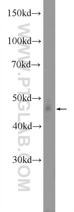 YBX1 Rabbit anti-Human, Mouse, Polyclonal, Proteintech 20 &mu;L; Unconjugated:Antibodies,