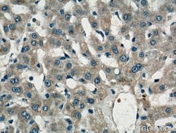 LASS2 Rabbit anti-Human, Mouse, Polyclonal, Proteintech:Anticorps:Anticorps