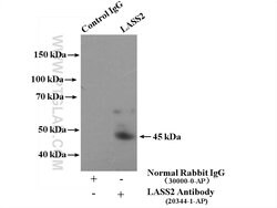 LASS2 Rabbit anti-Human, Mouse, Polyclonal, Proteintech:Anticorps:Anticorps