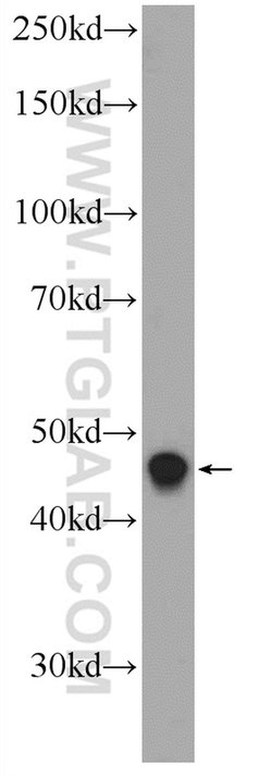 LASS2 Rabbit anti-Human, Mouse, Polyclonal, Proteintech:Anticorps:Anticorps