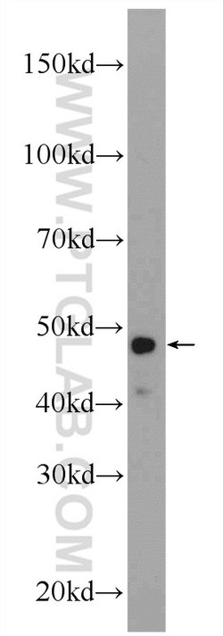LASS2 Rabbit anti-Human, Mouse, Polyclonal, Proteintech:Anticorps:Anticorps