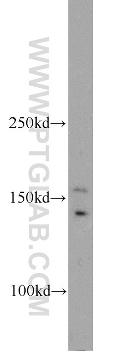 UBN1 Rabbit anti-Human, Mouse, Rat, Polyclonal, Proteintech:Antibodies:Primary
