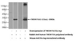 TMEM176A Rabbit anti-Human, Polyclonal, Proteintech 150 &mu;L; Unconjugated:Antibodies,