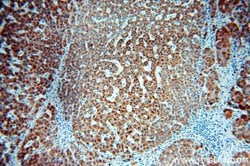 PECI Rabbit anti-Human, Mouse, Polyclonal, Proteintech:Antibodies:Primary