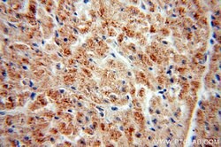 PECI Rabbit anti-Human, Mouse, Polyclonal, Proteintech:Antibodies:Primary
