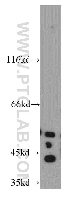 PECI Rabbit anti-Human, Mouse, Polyclonal, Proteintech:Antibodies:Primary