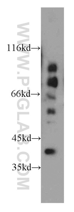 PECI Rabbit anti-Human, Mouse, Polyclonal, Proteintech:Antibodies:Primary