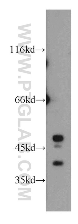 PECI Rabbit anti-Human, Mouse, Polyclonal, Proteintech:Antibodies:Primary