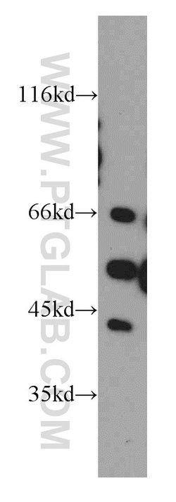 PECI Rabbit anti-Human, Mouse, Polyclonal, Proteintech:Antibodies:Primary