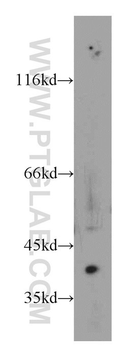 PECI Rabbit anti-Human, Mouse, Polyclonal, Proteintech:Antibodies:Primary
