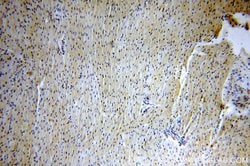 ZNF146 Rabbit anti-Human, Mouse, Rat, Polyclonal, Proteintech 20 &mu;L;