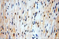 ZNF146 Rabbit anti-Human, Mouse, Rat, Polyclonal, Proteintech 20 &mu;L;