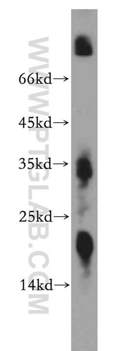 ZNF146 Rabbit anti-Human, Mouse, Rat, Polyclonal, Proteintech 20 &mu;L;