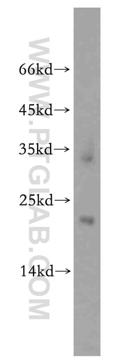 ZNF146 Rabbit anti-Human, Mouse, Rat, Polyclonal, Proteintech 20 &mu;L;