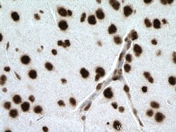 SNRPE Rabbit anti-Human, Mouse, Rat, Polyclonal, Proteintech:Antibodies:Primary