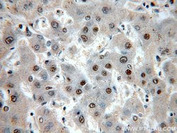 SNRPE Rabbit anti-Human, Mouse, Rat, Polyclonal, Proteintech:Antibodies:Primary
