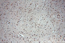 SNRPE Rabbit anti-Human, Mouse, Rat, Polyclonal, Proteintech:Antibodies:Primary