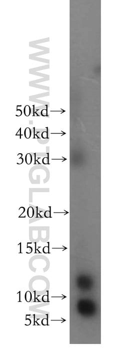 SNRPE Rabbit anti-Human, Mouse, Rat, Polyclonal, Proteintech:Antibodies:Primary