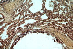 C11orf51 Rabbit anti-Human, Mouse, Rat, Polyclonal, Proteintech:Antibodies:Primary