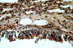 C11orf51 Rabbit anti-Human, Mouse, Rat, Polyclonal, Proteintech:Antibodies:Primary