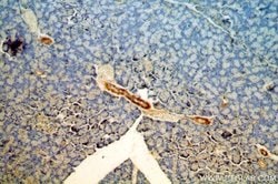 C11orf51 Rabbit anti-Human, Mouse, Rat, Polyclonal, Proteintech:Antibodies:Primary