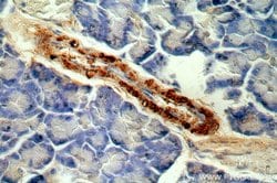 C11orf51 Rabbit anti-Human, Mouse, Rat, Polyclonal, Proteintech:Antibodies:Primary