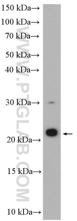 C11orf51 Rabbit anti-Human, Mouse, Rat, Polyclonal, Proteintech:Antibodies:Primary