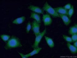 Fibulin-1 Rabbit anti-Human, Mouse, Rat, Polyclonal, Proteintech:Antibodies:Primary