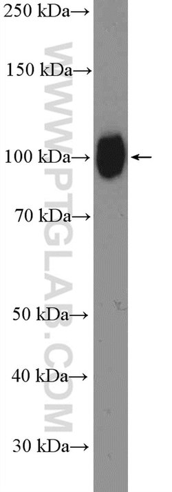 Fibulin-1 Rabbit anti-Human, Mouse, Rat, Polyclonal, Proteintech:Antibodies:Primary