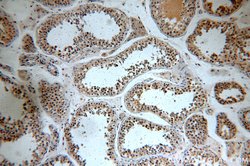 C5orf44 Rabbit anti-Human, Mouse, Rat, Polyclonal, Proteintech:Antibodies:Primary