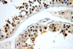 C5orf44 Rabbit anti-Human, Mouse, Rat, Polyclonal, Proteintech:Antibodies:Primary