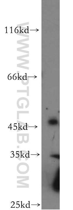 C5orf44 Rabbit anti-Human, Mouse, Rat, Polyclonal, Proteintech:Antibodies:Primary