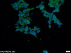 C5orf44 Rabbit anti-Human, Mouse, Rat, Polyclonal, Proteintech:Antibodies:Primary