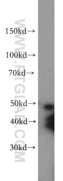 C5orf44 Rabbit anti-Human, Mouse, Rat, Polyclonal, Proteintech:Antibodies:Primary