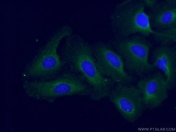USP33 Rabbit anti-Human, Mouse, Rat, Polyclonal, Proteintech:Antibodies:Primary