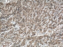 USP33 Rabbit anti-Human, Mouse, Rat, Polyclonal, Proteintech:Antibodies:Primary
